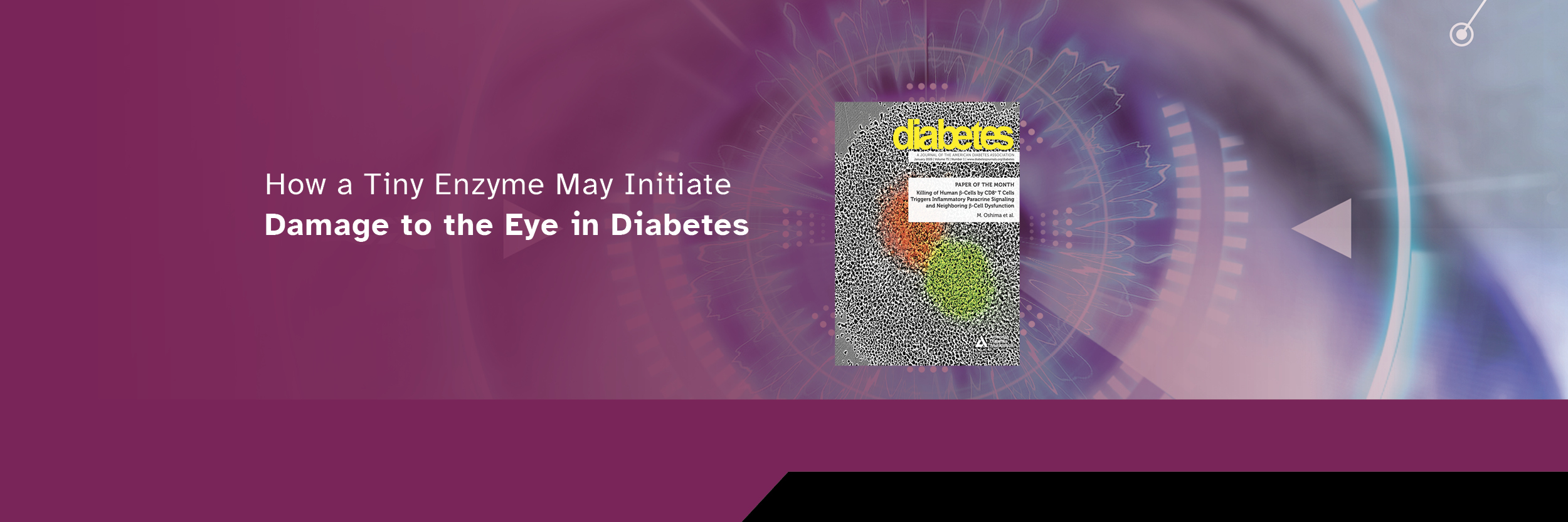 Doheny-Diabetes-study-Topper-2